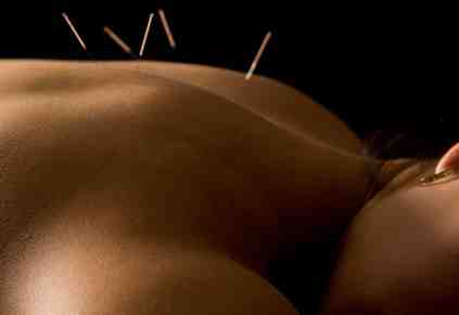 Acupuncture Facebook Advertising Tips to Lower Your Cost-Per-Lead