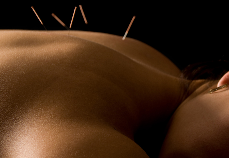 Acupuncture Facebook Advertising Tips to Lower Your Cost-Per-Lead